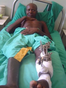 A Karimojong man injured during a raids lies on a hospital bed in Moroto.